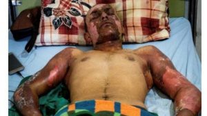 استفاده ترکیه از تسلیحات ممنوعه(فسفر و ناپالم) علیه غیرنظامیان در شمال سوریه 